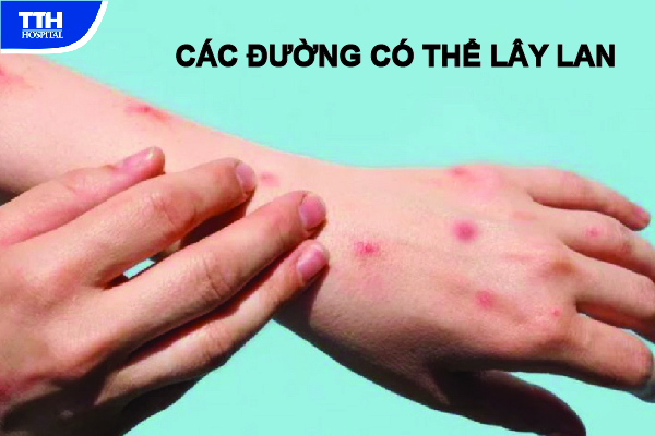 các con đường có thể lây lan