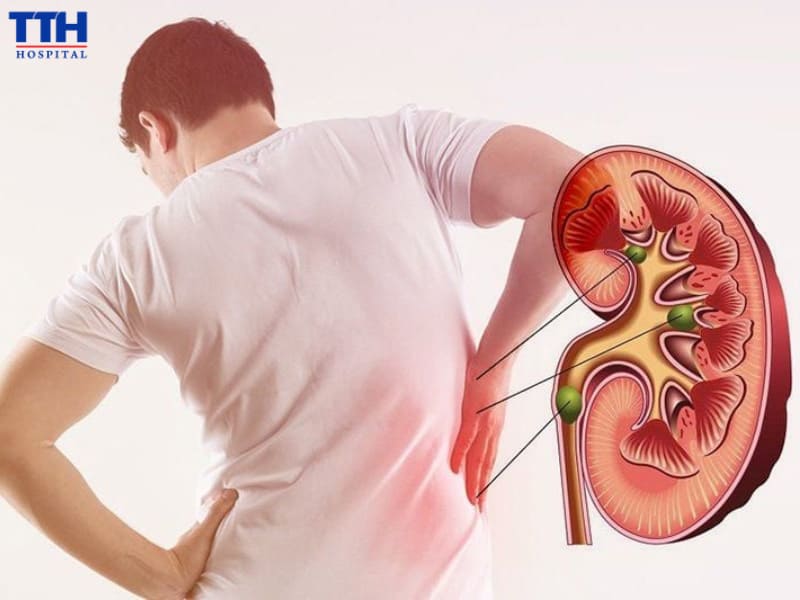 Nếu thấy thường xuyên đau lưng đặc biệt vùng thận bạn nên đi thăm khám ngay